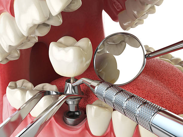 Best Cracked Tooth Emergency Dentist  in Daniels, WV